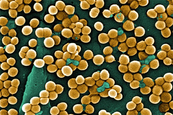 Close-up view of MRSA bacteria