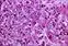 
						This stained microscope view, magnified 500 times, shows a kidney tissue sample from a patient diagnosed with invasive candidiasis, a bloodstream infection common among hospitalized patients. Assoc. Prof. Daniel Schmidt of UMass Lowell and Prof. Paul Kaufman of UMass Worcester are working on a molecule that can help prevent hospital-acquired infections.
					