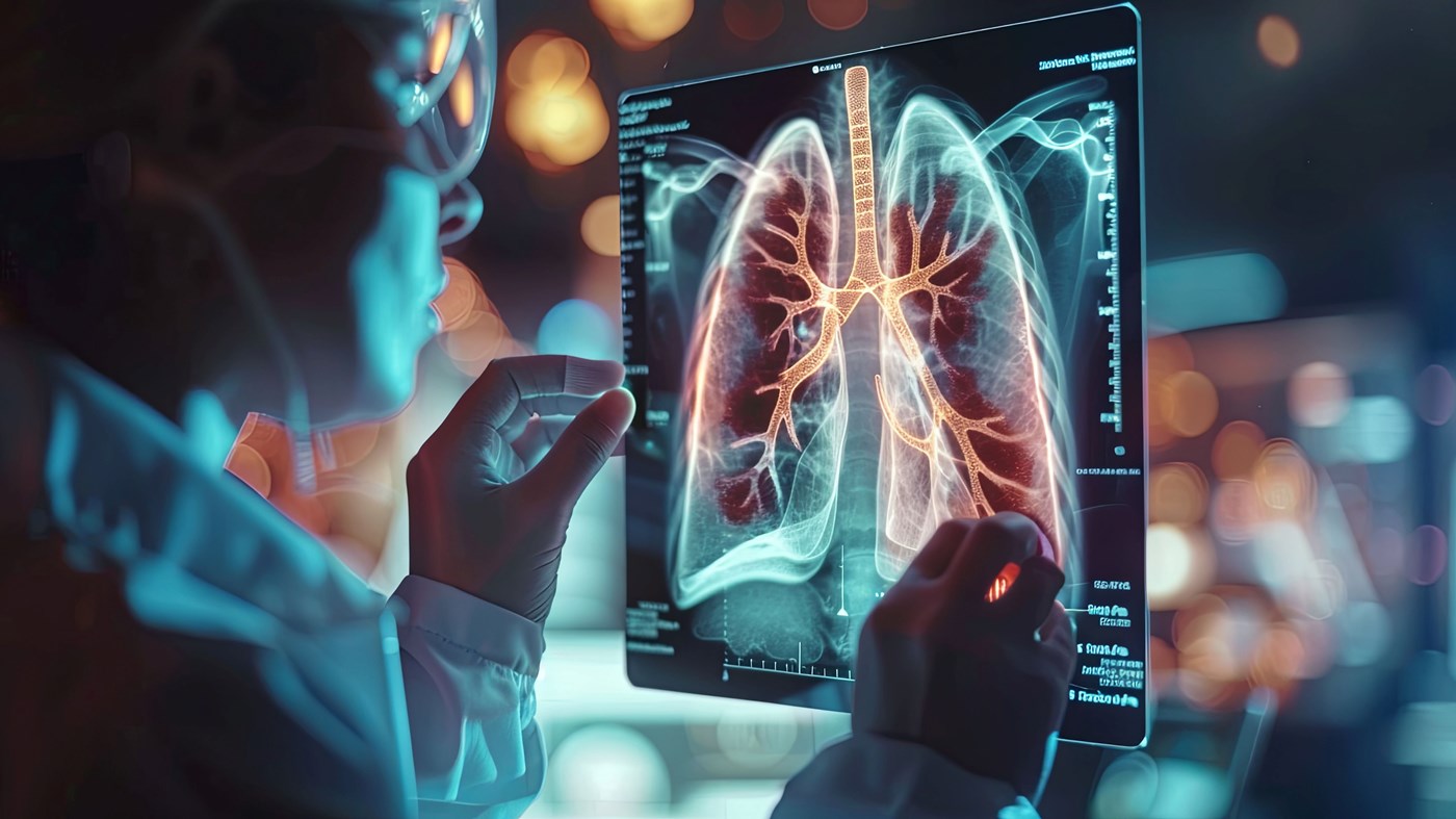 Medical professional reviews a contrast-enhanced image of lungs.