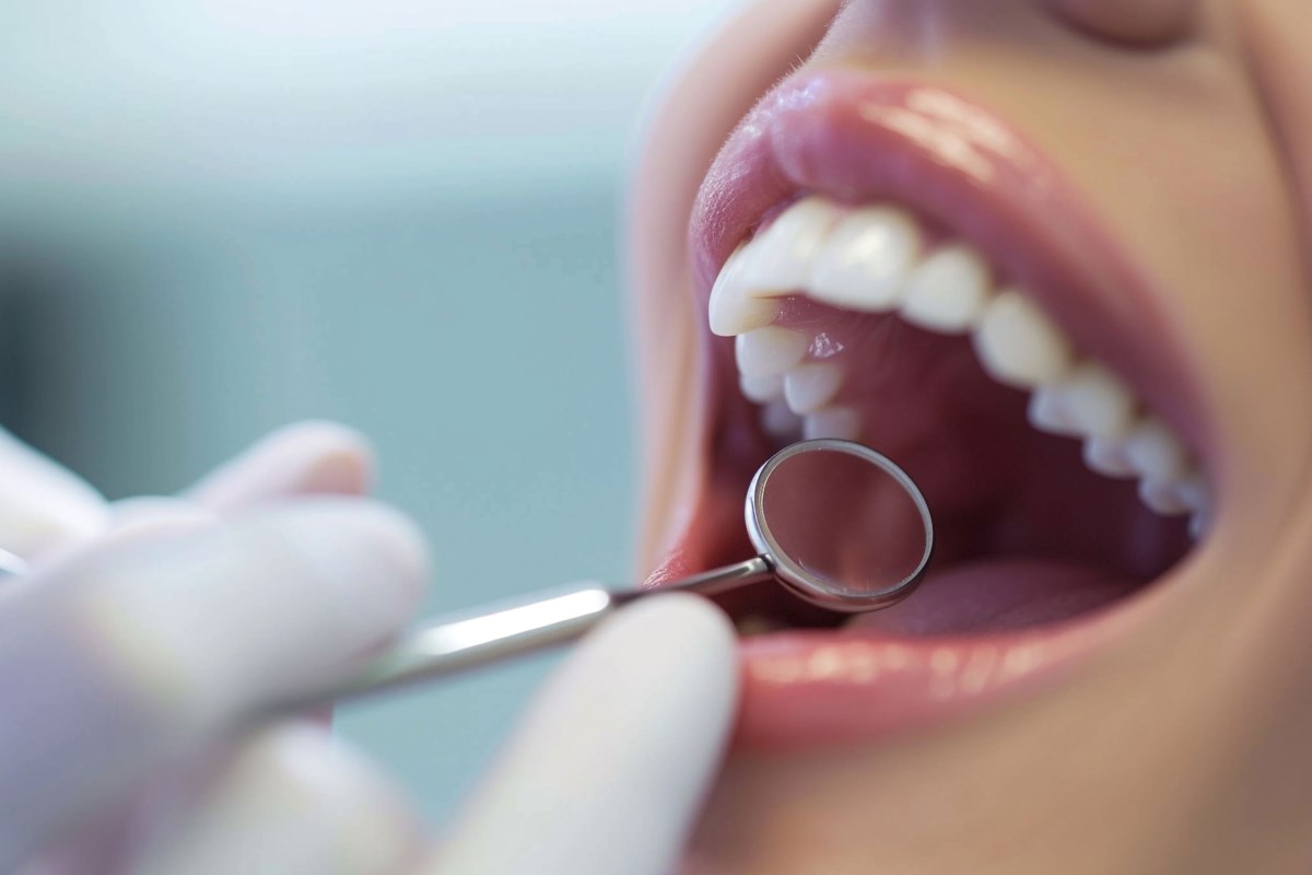 Close-up of a gloved hand holding a dental mirror inside an open mouth during an oral examination.